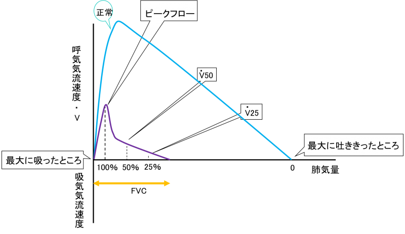 Flow-volume curve　3